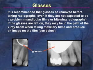 Glasses
It is recommended that glasses be removed before
taking radiographs, even if they are not expected to be
a problem (mandibular films or bitewing radiographs).
If the glasses are left on, they may be in the path of the
x-ray beam when taking maxillary films and produce
an image on the film (see below).




                 glasses
 