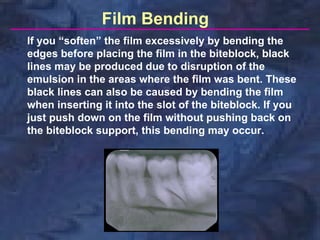 Film Bending
If you “soften” the film excessively by bending the
edges before placing the film in the biteblock, black
lines may be produced due to disruption of the
emulsion in the areas where the film was bent. These
black lines can also be caused by bending the film
when inserting it into the slot of the biteblock. If you
just push down on the film without pushing back on
the biteblock support, this bending may occur.
 