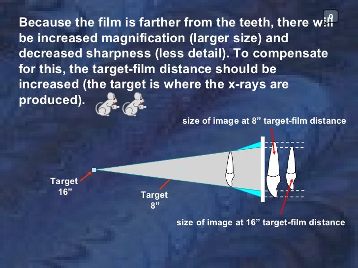 radiologyparallelingtechnique