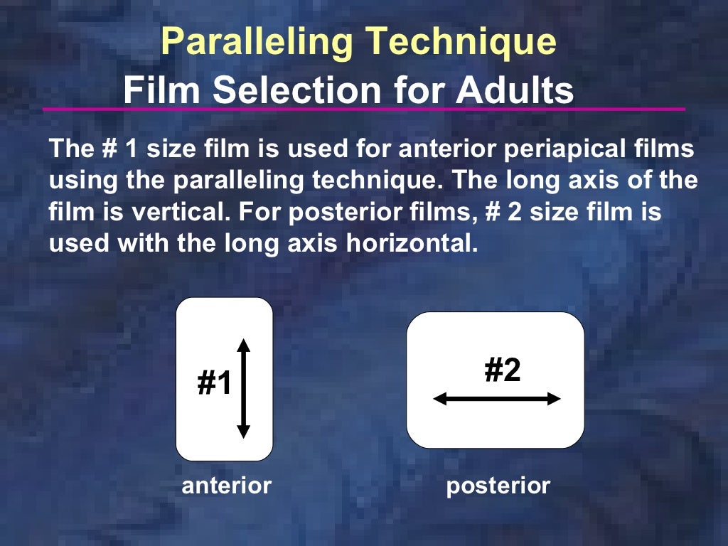 radiologyparallelingtechnique