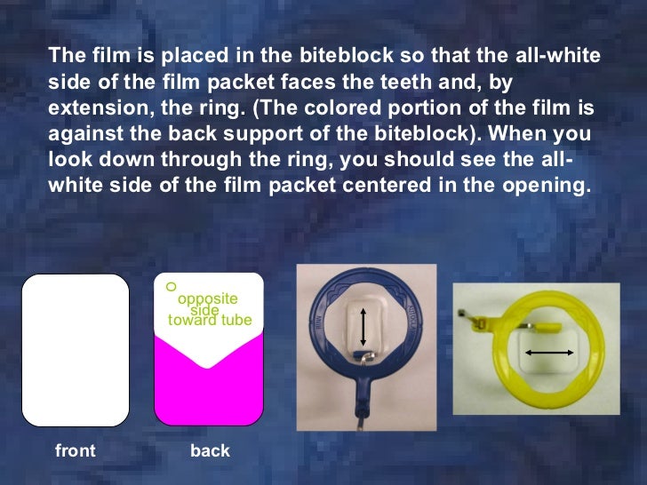 radiologyparallelingtechnique