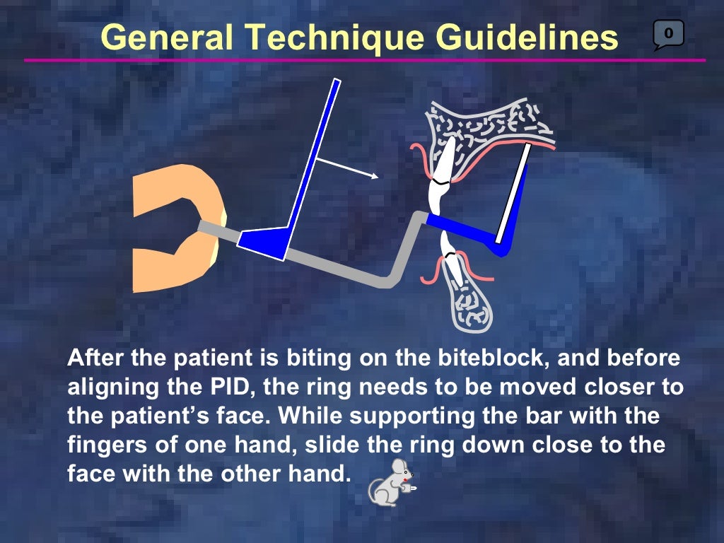 radiologyparallelingtechnique