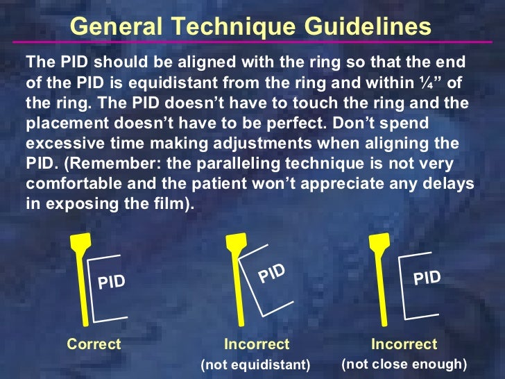 radiologyparallelingtechnique