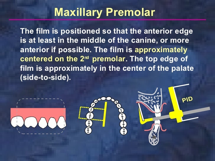 radiologyparallelingtechnique