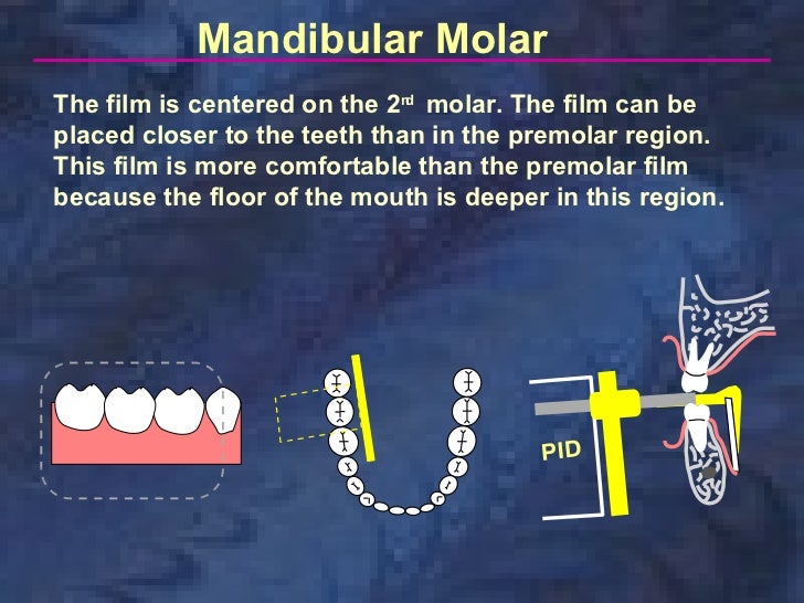 radiologyparallelingtechnique