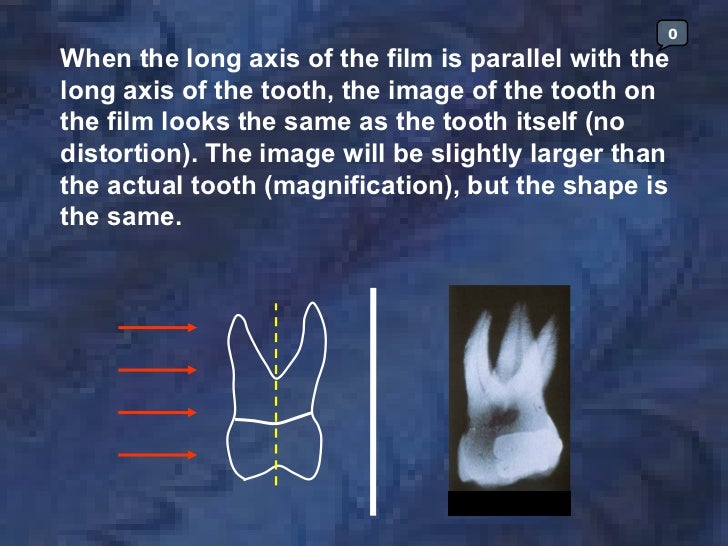radiologyparallelingtechnique