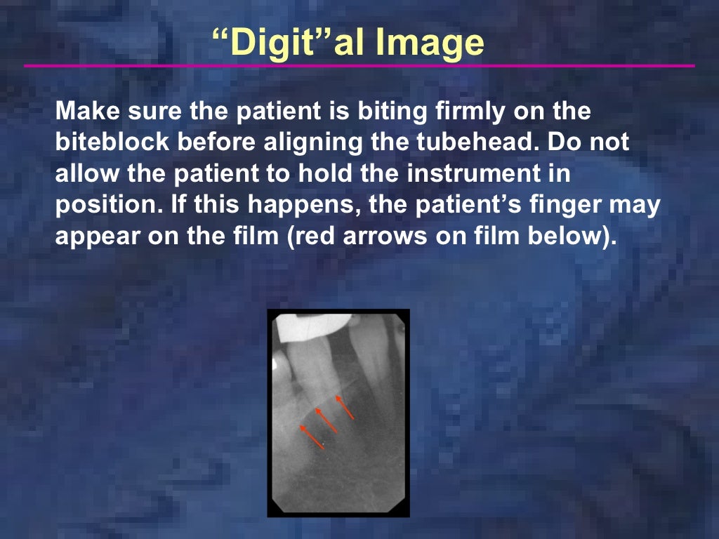 radiologyparallelingtechnique