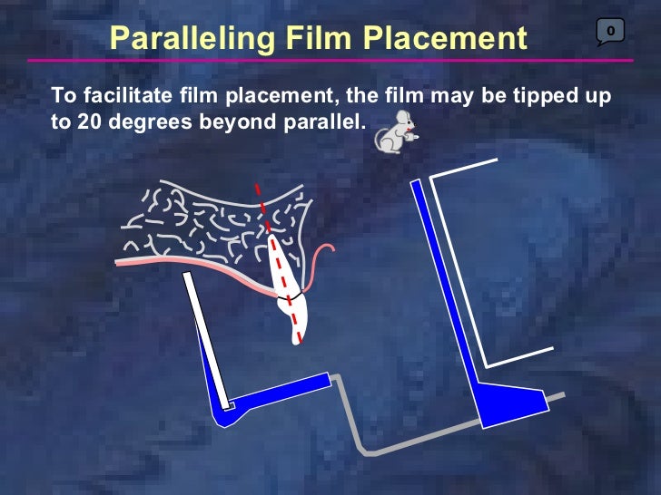 paralleling technique
