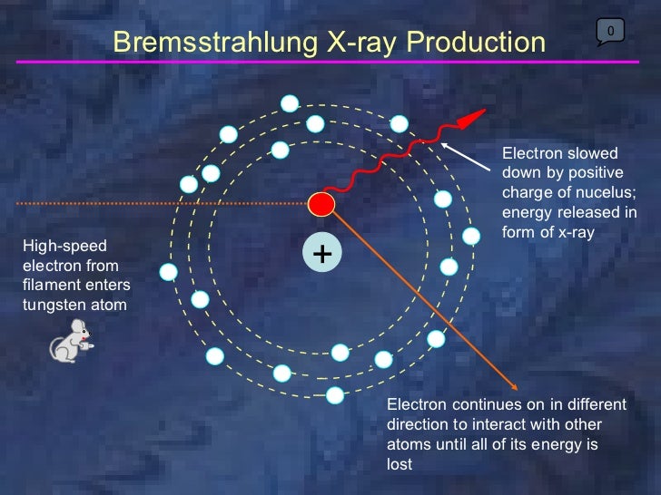 radiology xray production