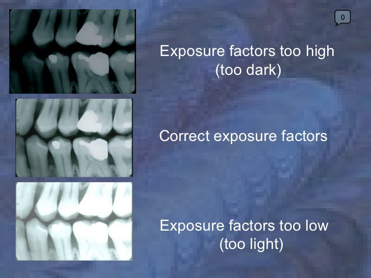 radiology xray production