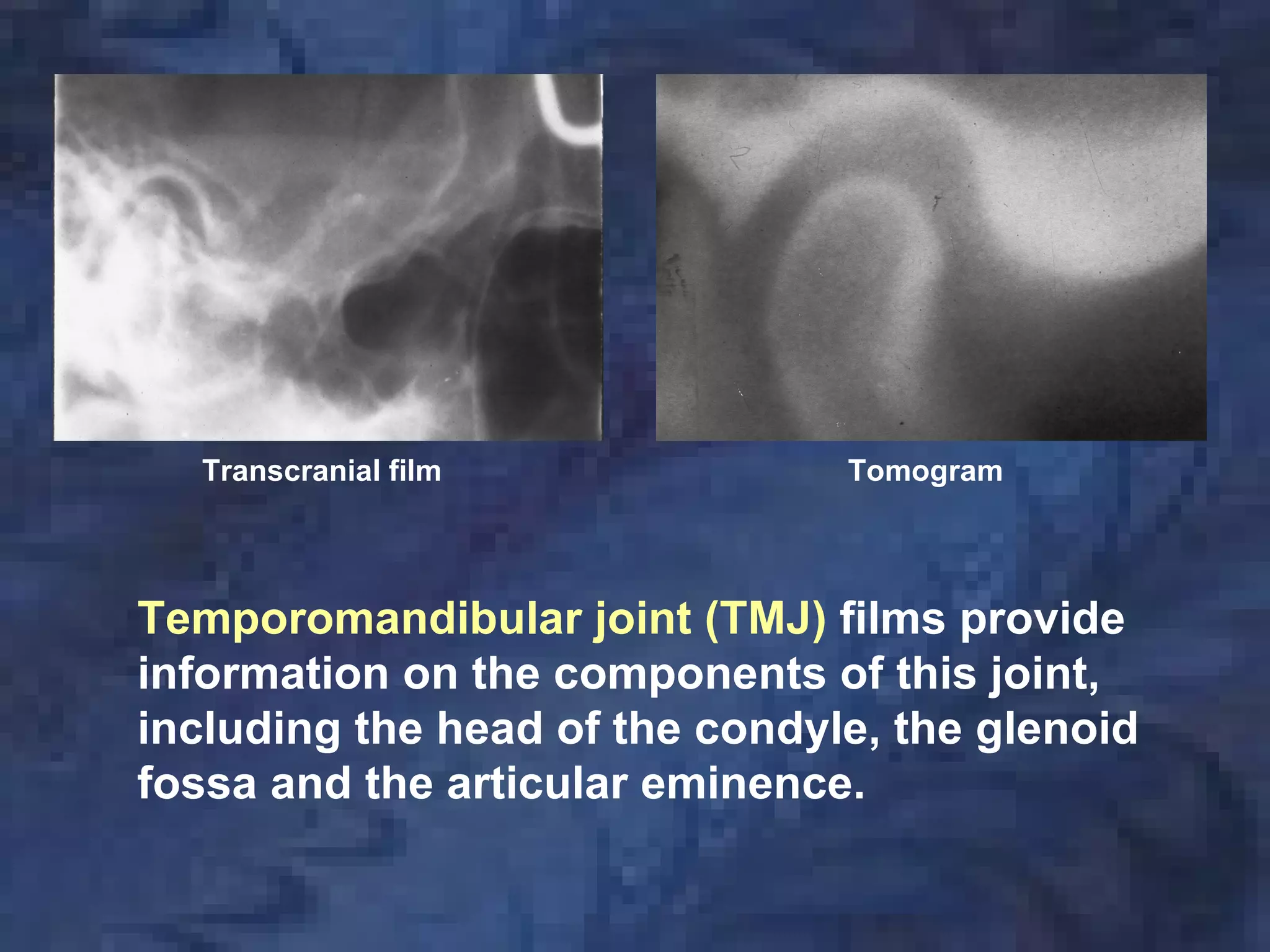 radiology-x-ray film & screens | PDF