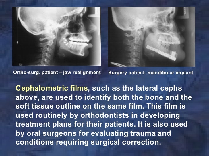 radiologyxray film & screens