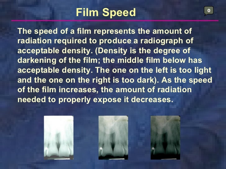 radiologyxray film & screens