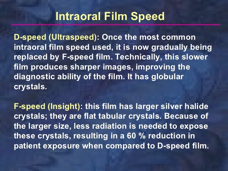 radiology x ray film amp screens x ray film speed chart