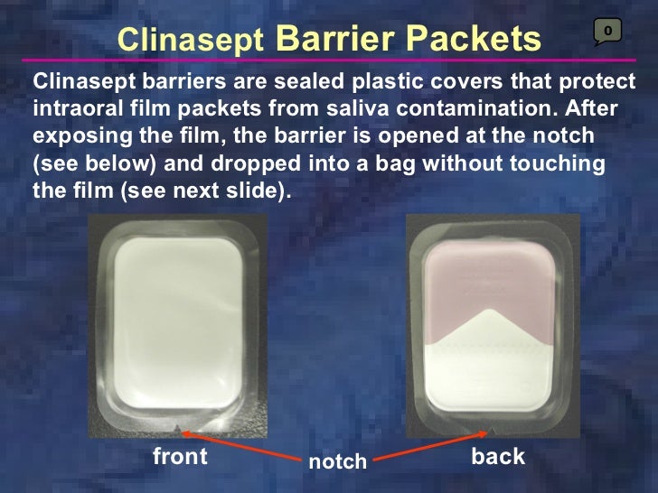 radiologyxray film & screens