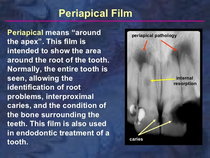 radiologyxray film & screens