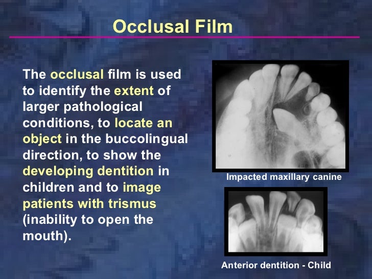 radiologyxray film & screens