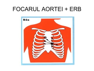 FOCARUL AORTEI + ERB
 