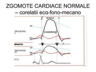 ZGOMOTE CARDIACE NORMALE
– corelatii ecg-fono-mecano
 
