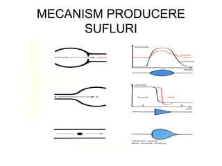 MECANISM PRODUCERE
SUFLURI
 