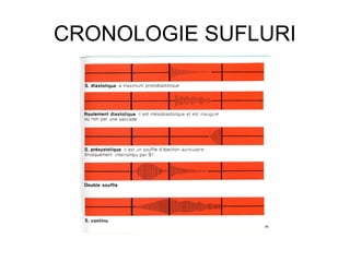 CRONOLOGIE SUFLURI
 