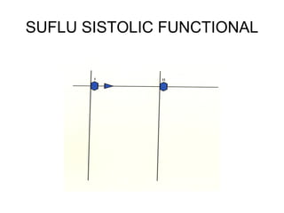 SUFLU SISTOLIC FUNCTIONAL
 