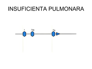 INSUFICIENTA PULMONARA
 