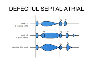 DEFECTUL SEPTAL ATRIAL
 