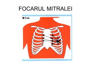 FOCARUL MITRALEI
 