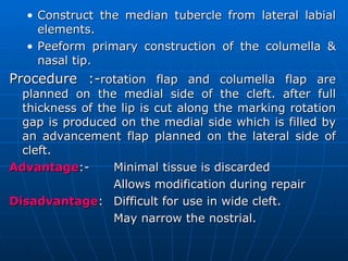 cleft management | PPT