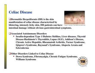 Celiac Disease
Dermatitis Herpetiformis (DH) is the skin
manifestation of celiac disease characterized by
blistering, intensely itchy skin. DH patients can have
intestinal damage without obvious gastrointestinal symptoms.
Associated Autoimmune Disorders
Insulin-dependent Type 1 Diabetes Mellitus, Liver diseases, Thyroid
Disease-Hashimoto’s Thyroiditis, Lupus (SLE), Addison’s Disease,
Chronic Active Hepatitis, Rheumatoid Arthritis, Turner Syndrome,
Sjögren’s Syndrome, Raynaud’s Syndrome, Alopecia Areata and
Scleroderma
Other Disorders Linked to Celiac Disease
Down Syndrome, Fibromyalgia, Chronic Fatigue Syndrome,
Williams Syndrome
 