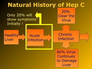 Natural History of Hep C
Healthy
Liver
Acute
Infection
Chronic
Infection
20%
Clear the
Virus
80% Virus
Continues
to Damage
Liver
Only 20% will
show symptoms
Initially !
 