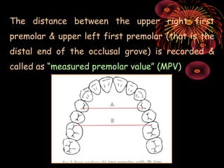 The distance between the upper right first
premolar & upper left first premolar (that is the
distal end of the occlusal gr...