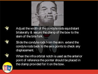 Condylar Rods 32191006 orientation-jaw-relation-prostho | PPT