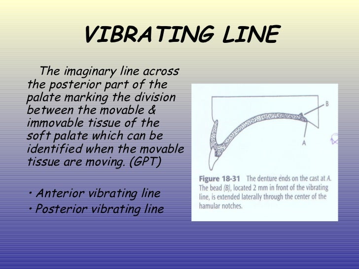 posterior palatal seal