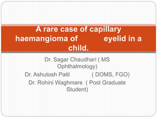 Dr. Sagar Chaudhari ( MS
Ophthalmology)
Dr. Ashutosh Patil ( DOMS, FGO)
Dr. Rohini Waghmare ( Post Graduate
Student)
A rare case of capillary
haemangioma of eyelid in a
child.
 