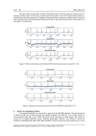 Efficient electrocardiogram signal compression algorithm using dual ...