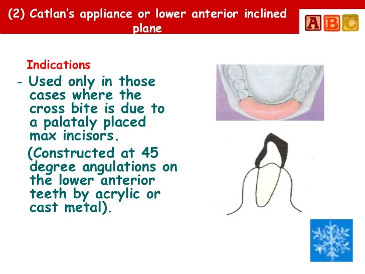 anterior crossbites in primary mixed dentitionpedo