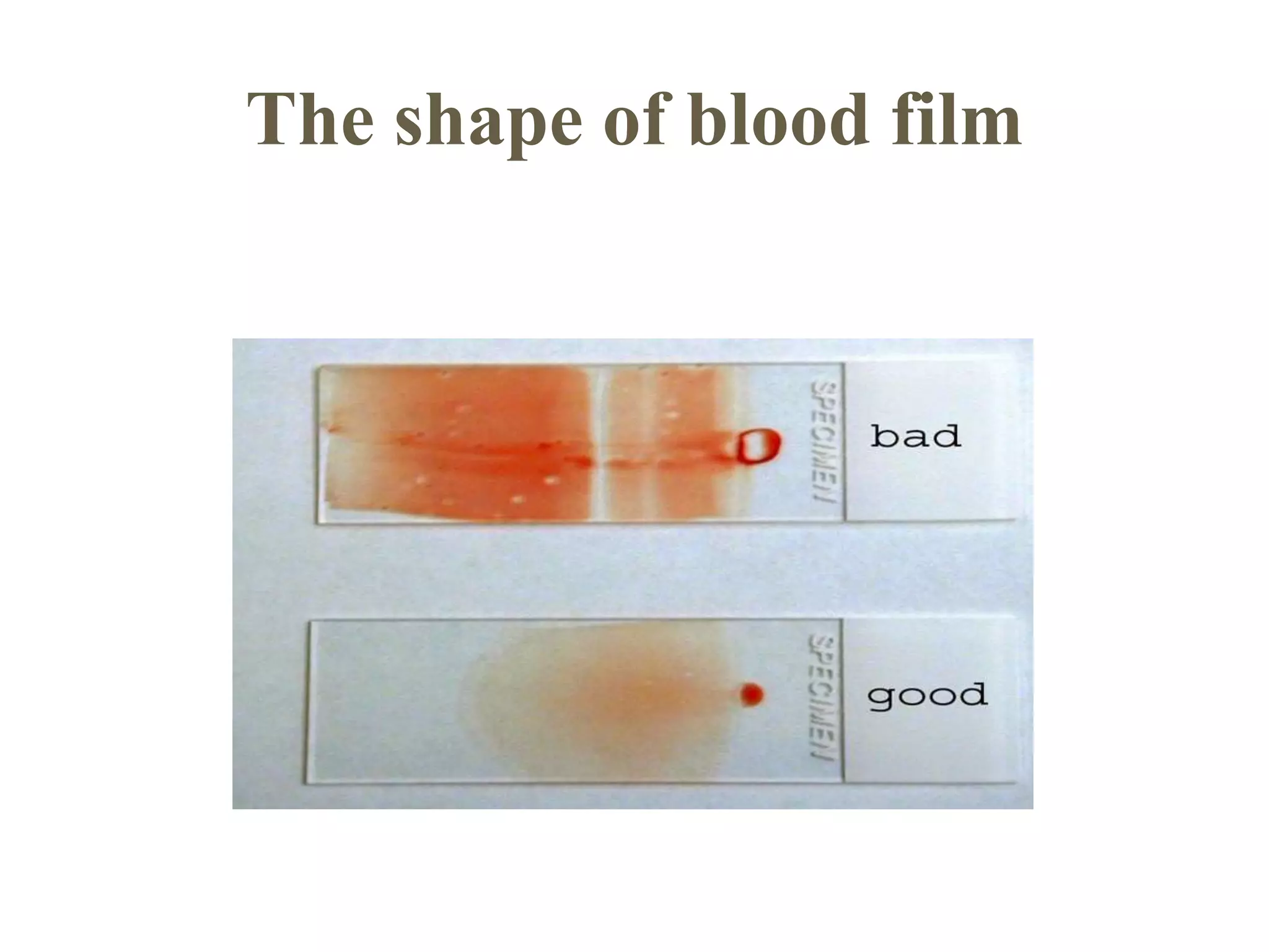 Routine Staining special and routine stains in haematology 1 | PPTX