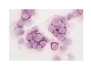 Routine Staining special and routine stains in haematology 1 | PPTX