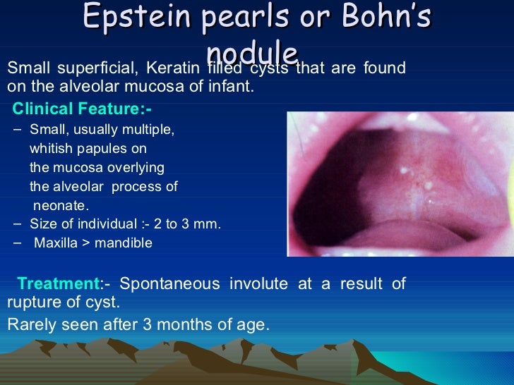 predentate period pedo