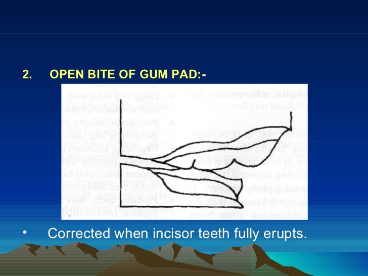 predentate period pedo