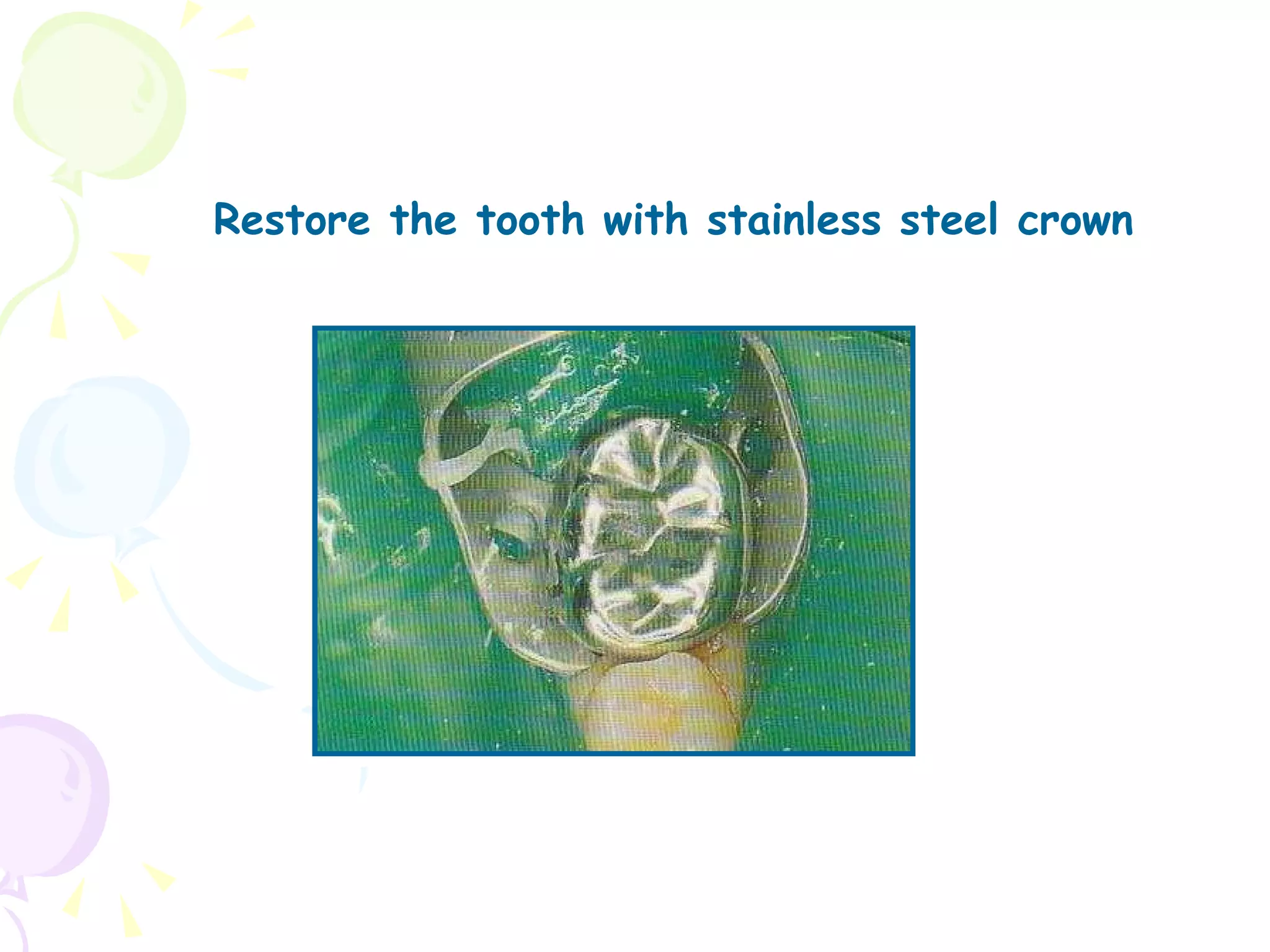 Restore the tooth with stainless steel crown 