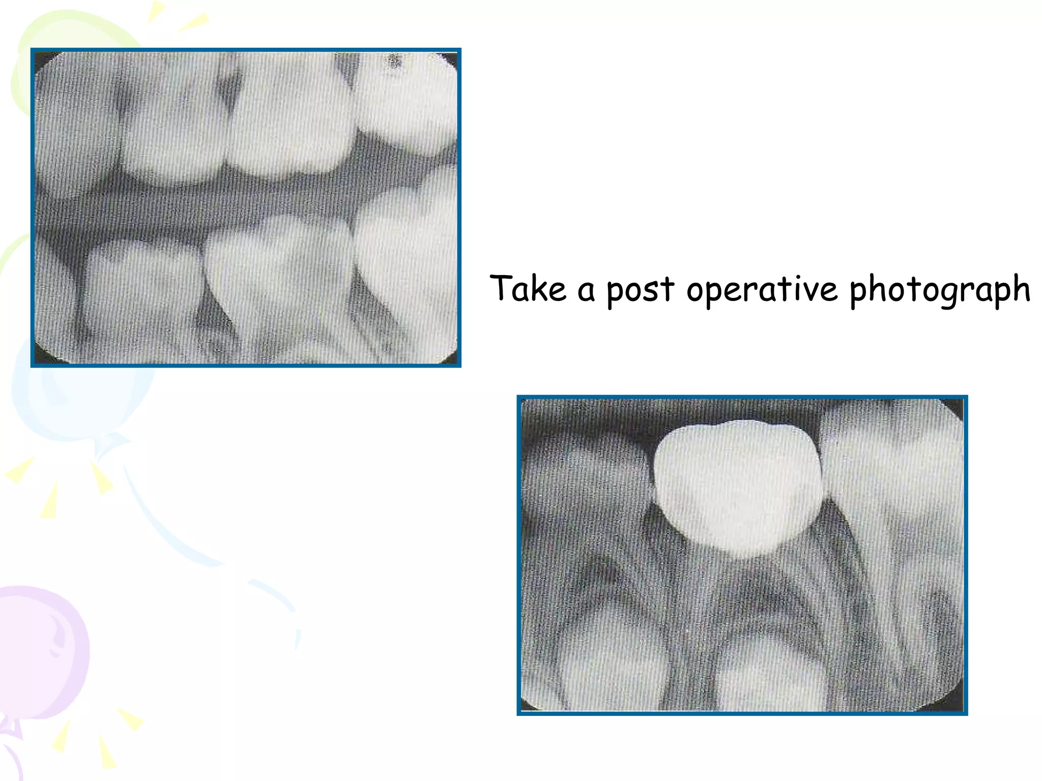 Take a post operative photograph 