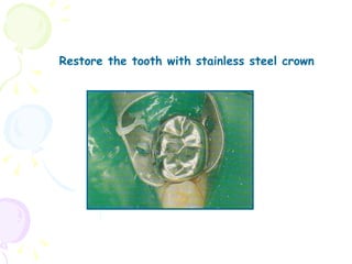 Restore the tooth with stainless steel crown 