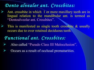 Dento alvealor ant. Crossbites: Ant. crossbite in which  1 or more maxillary teeth are in lingual relation to the mandibular ant. is termed as  “Dentoalveolar ant. Crossbites”. This is manifested as single tooth crossbite & usually occurs due to over retained deciduous teeth.   Functional ant. Crossbites: Also called  “Pseudo Class III Malocclusion”. Occurs as a result of occlusal prematurities .   