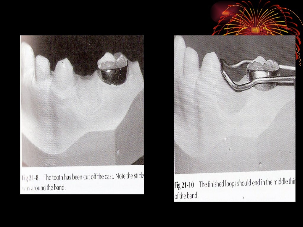 spacemaintainerspedo