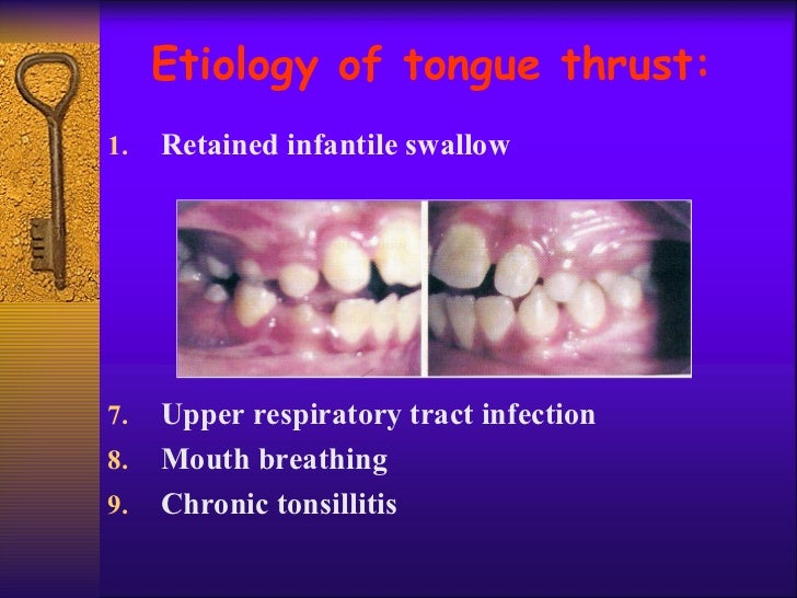 Tongue Thrusting
