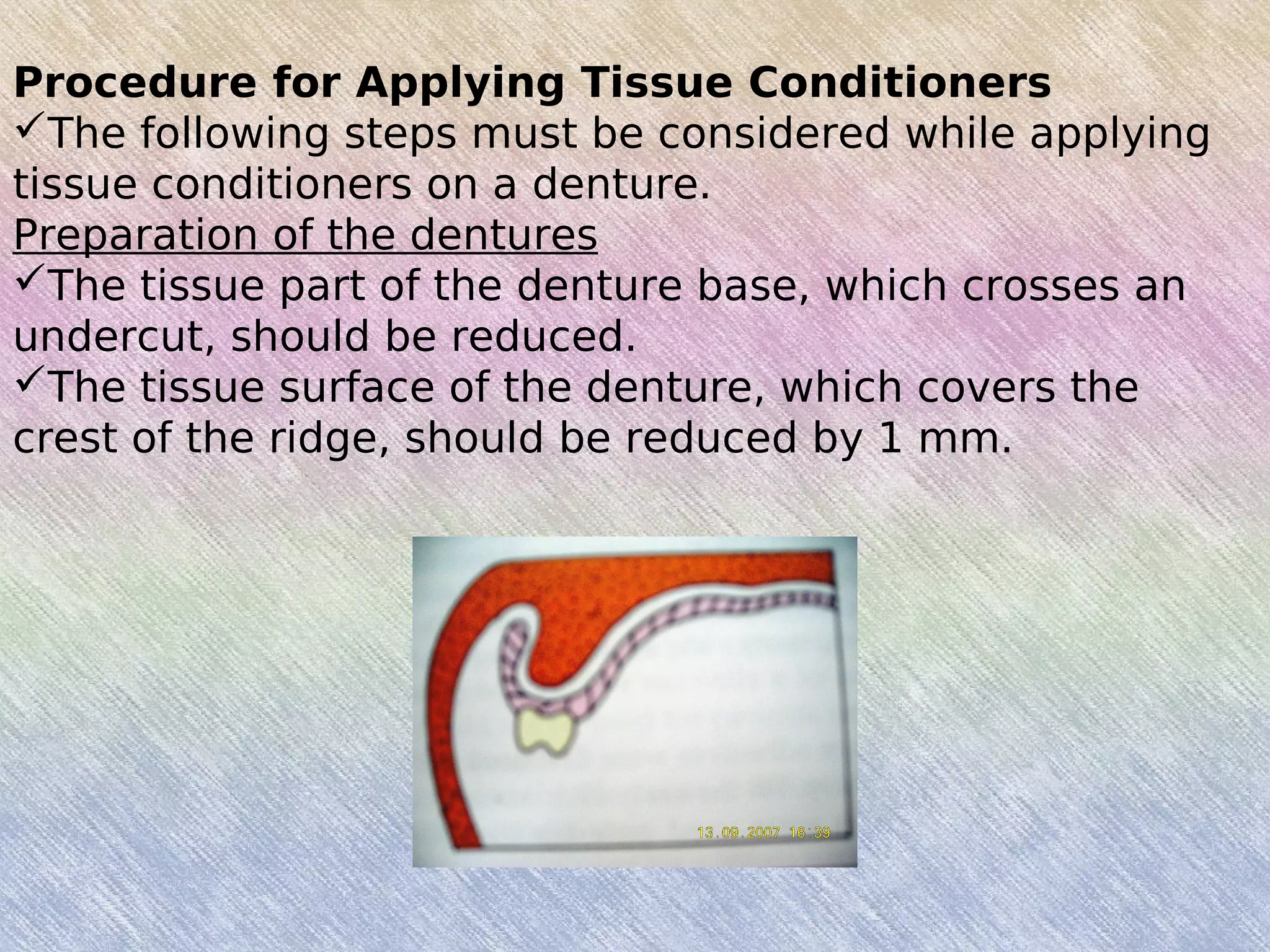 Procedure for Applying Tissue Conditioners
The following steps must be considered while applying
tissue conditioners on a denture.
Preparation of the dentures
The tissue part of the denture base, which crosses an
undercut, should be reduced.
The tissue surface of the denture, which covers the
crest of the ridge, should be reduced by 1 mm.
 