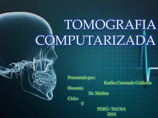 {
TOMOGRAFIA
COMPUTARIZADA
Presentado por:
Karlha Coronado Calderón
Docente:
Dr. Medina
Ciclo:
V
PERÚ- TACNA
2016
 